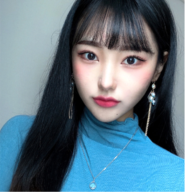 Model with V-line face after contour tox fat reduction